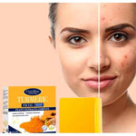 Jabón de Cúrcuma Natural -   ¡LIBERATE DE LAS MANCHAS Y EL ACNE! 🧼🍂 Paga 1 y Lleva 2😱