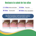 PARCHE CORRECTOR UÑA NANEL – Corrige, protege y recupera la forma natural de tus uñas